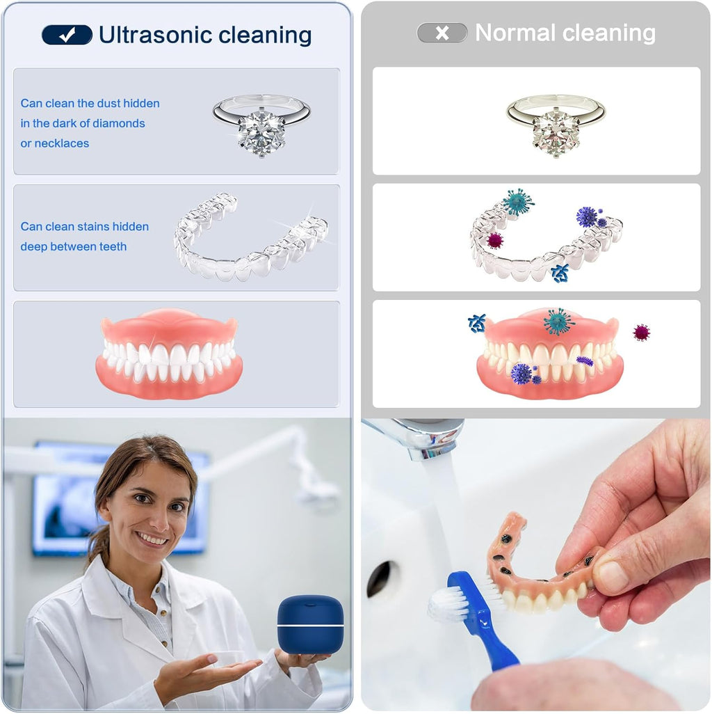 ® Dental Ultrasonic Retainer Cleaner(With Heating Clean) for Retainer,Dentures, Mouth Guard,Aligner,Toothbrush Head,Ultrasonic Retainer Cleaner Machine for All Jewelry