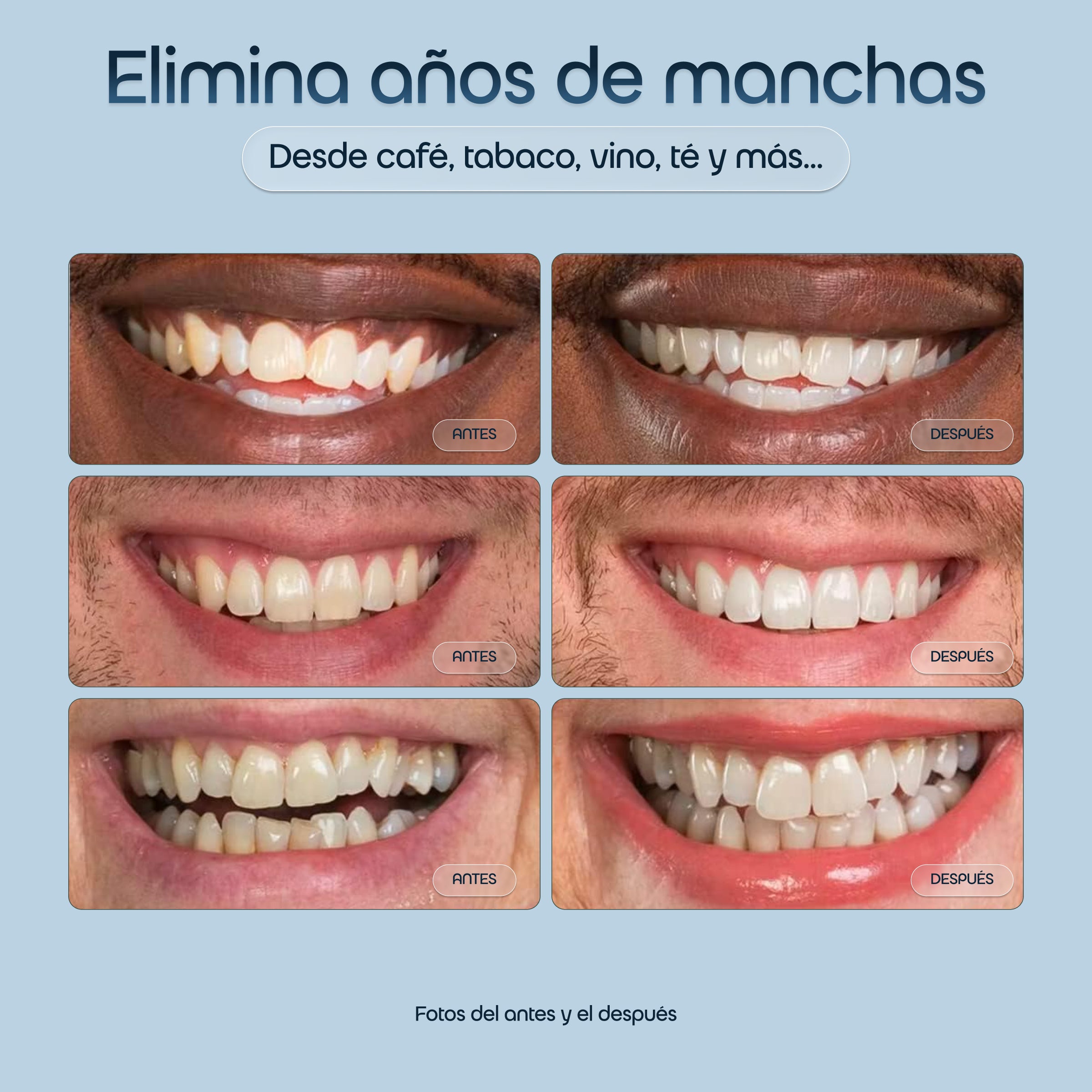 Blanqueador Dental